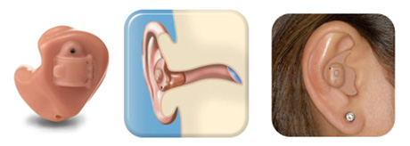 aparelho-auditivo-intra-auricular-ITE completo