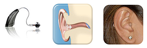 aparelho-auditivo-receptor-no-canal-RIC completo