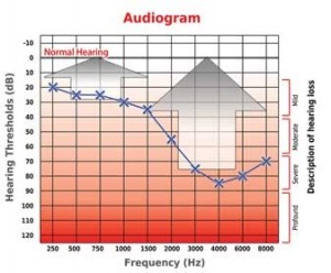 Aparelhos Auditivos Analógicos